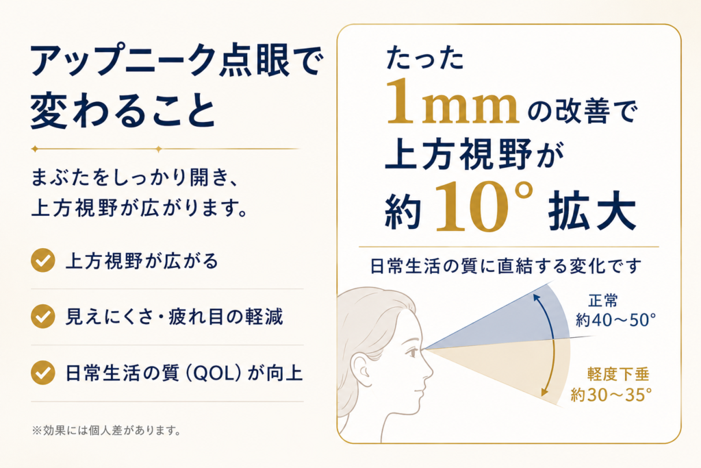 アップニーク点眼で変わることとは